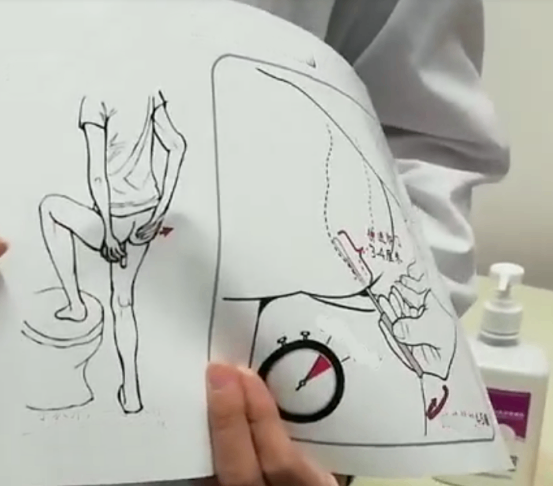 肛拭子自己取样过程.png