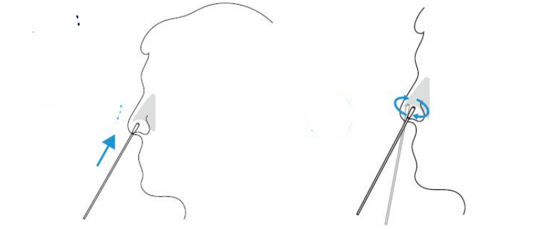 鼻咽拭子采样示意图