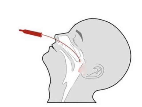 鼻咽拭子采集示意图.png